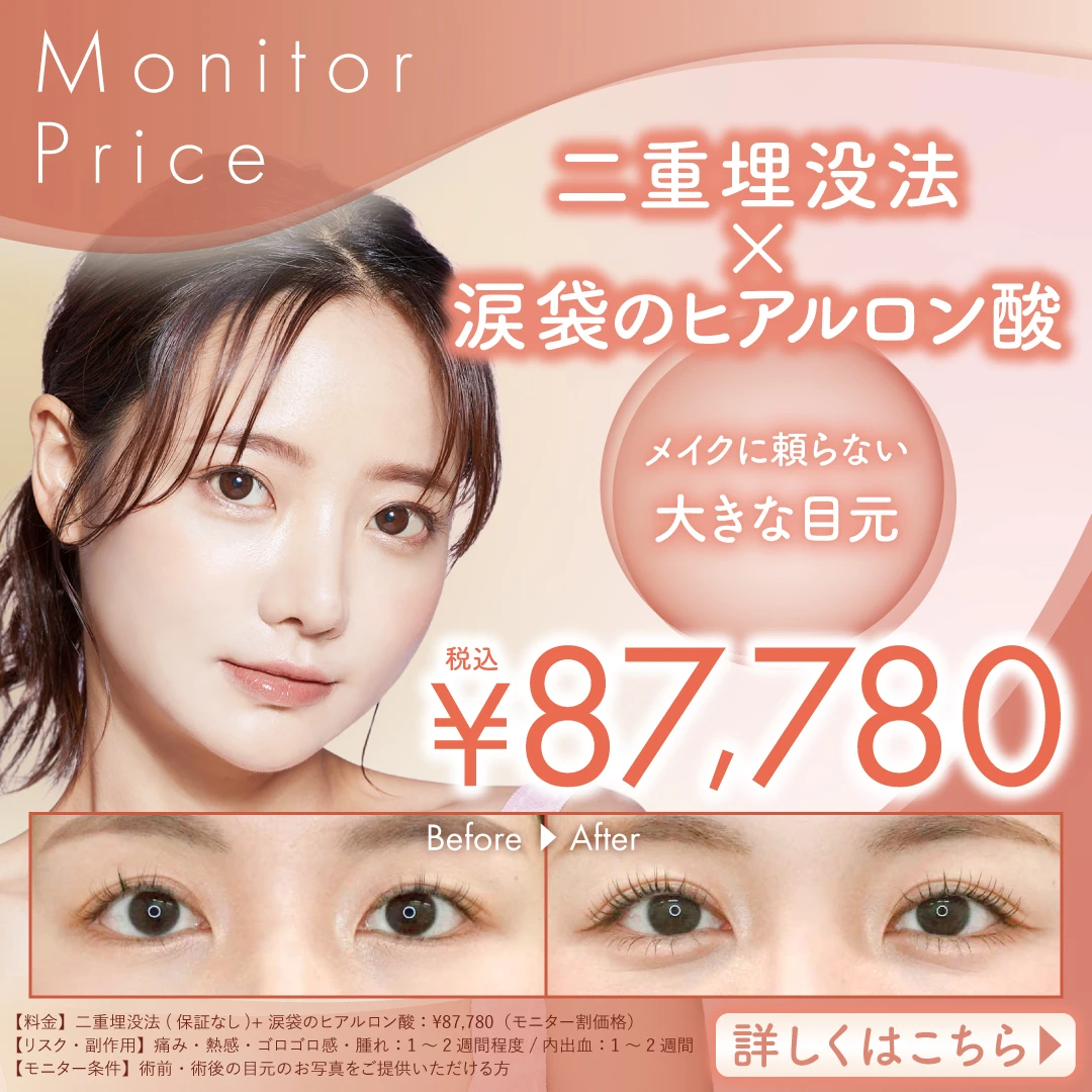 二重埋没法＋涙袋のヒアルロン酸がお得なセットメニュー
